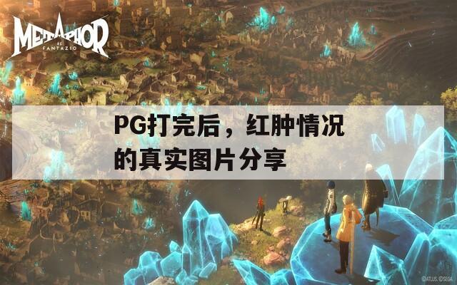 PG打完后，红肿情况的真实图片分享